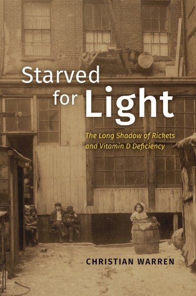 Starved for Light: The Long Shadow of Rickets and Vitamin D Deficiency